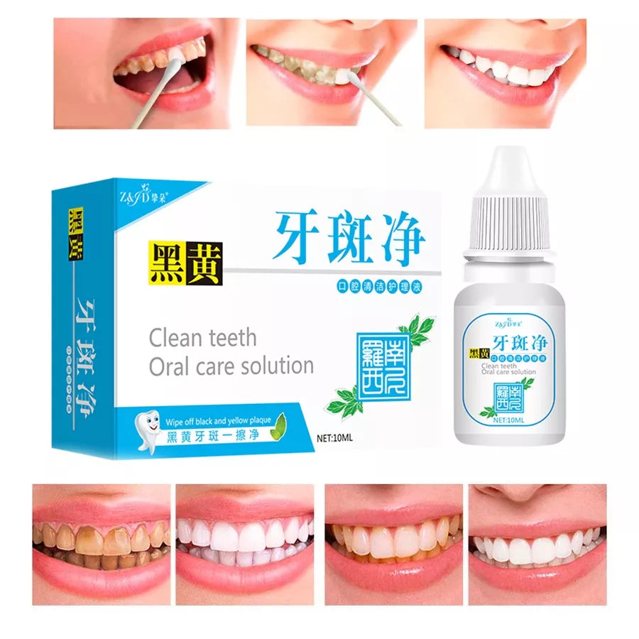 Dentes Essência De Oral Limpeza Remover Manchas De Fresco Ferramentas Dental