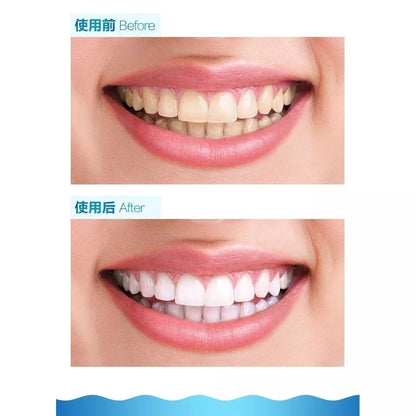 Mini Aparelho De Limpeza De Dentes / Branqueadora / Oral Blu-Ray
