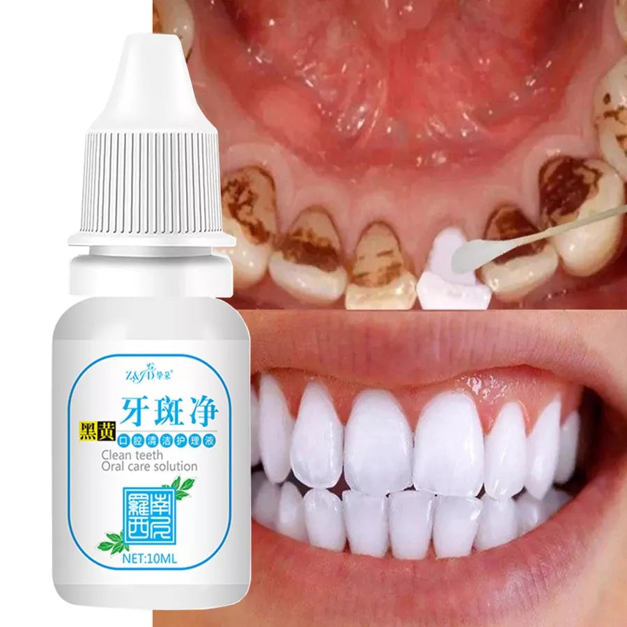 Dentes Essência De Oral Limpeza Remover Manchas De Fresco Ferramentas Dental
